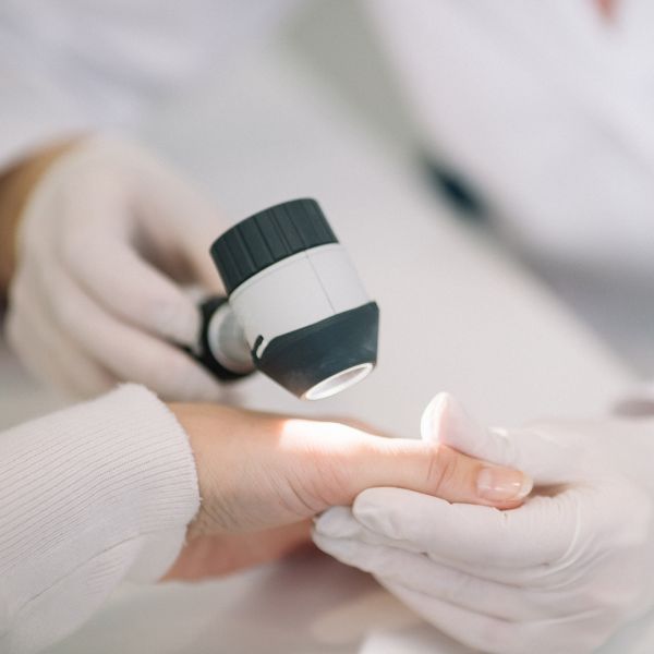 dermatoszkóp kéz bőrgyógyászat vizsgálat