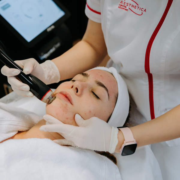 Rubint Rella Dermaclear hidradermabráziós arckezelés