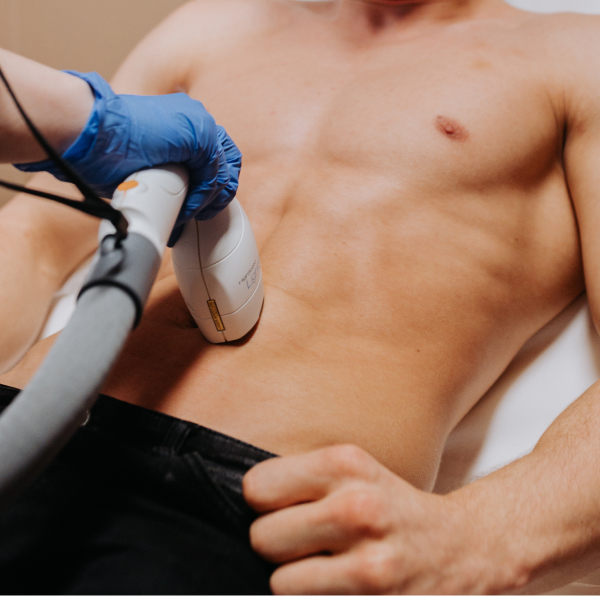 Titanlight végleges lézeres szőrtelenítés